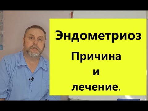 Видео: Борьба с эндометриозом: от причин до лечения.