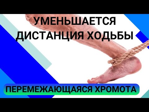 Видео: УМЕНЬШЕНИЕ ДИСТАНЦИИ ХОДЬБЫ или ПЕРЕМЕЖАЮЩАЯСЯ ХРОМОТА