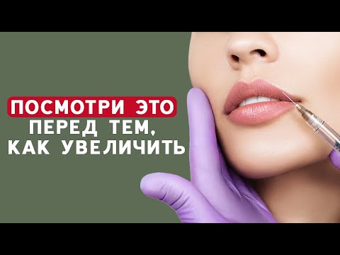 Видео: Увеличение губ – вечный ТРЕНД! Как выбрать препарат и врача? Врач о процедуре увеличения губ