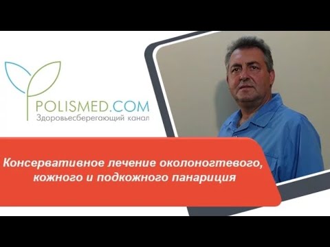 Видео: Консервативное лечение околоногтевого, кожного и подкожного панариция