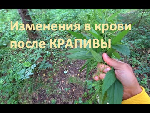 Видео: Изменения в крови после ВИТРАССа из крапивы