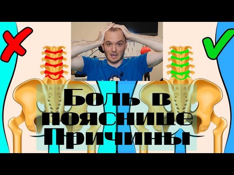 Видео: Боль в пояснице. Причины. Способы лечения. Кинезиология