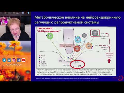 Видео: Ановуляторный синдром l Пустотина О. А.