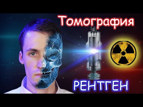 Видео: Сделал Томографию на  самодельном РЕНТГЕНЕ!