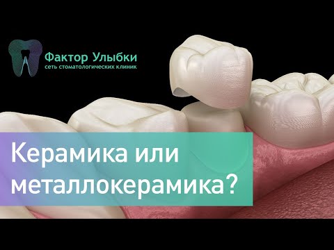 Видео: Керамика или металлокерамика - какую коронку выбрать?