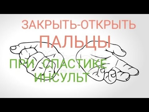 Видео: КАК ЗАКРЫТЬ И ОТКРЫТЬ ПАЛЬЦЫ ПРИ СППСТИКЕ ПОСЛЕ ИНСУЛЬТА