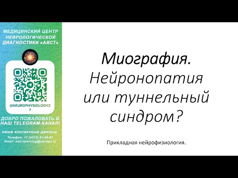 Видео: Тема: Миография. Нейронопатия или туннельный синдром?