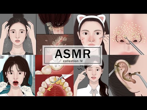 Видео: Масштабирование кожи головы ASMR, удаление прыщей, чистка ушей, лечение зубов