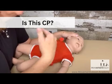 Видео: Атипичное развитие ребёнка. У моего ребёнка детский церебральный паралич? Меня беспокоит его разв...