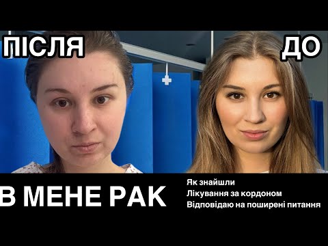 Видео: Рак лікування за кордоном в Лондоні