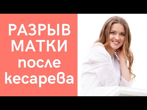 Видео: ГЛАВНОЕ! Естественные роды после кесарева сечения