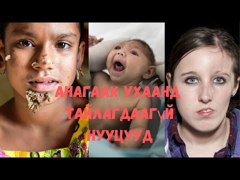 Видео: Анагаах ухааны тайлж чадаагүй 10 эмгэг