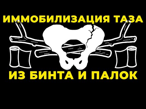 Видео: Перелом таза и стабилизация подручными методами #ПроСМП