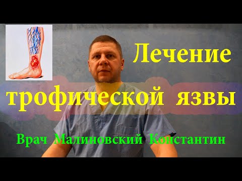 Видео: Бесценный Рецепт Мази от трофических язв. ПРОВЕРЕНО. 100% результат