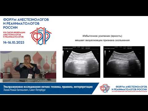 Видео: УЗИ легких Лахин РЕ 23