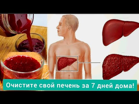 Видео: ОЧИСТИТЕ  ПЕЧЕНЬ  БЕЗ  ТАБЛЕТОК -ЗА 7 ДНЕЙ 😀CLEANSE YOUR LIVER WITHOUT PILLS@i1987. 