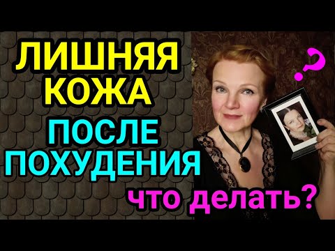 Видео: лишняя кожа после похудения / как я похудела на 94 кг и улучшила здоровье