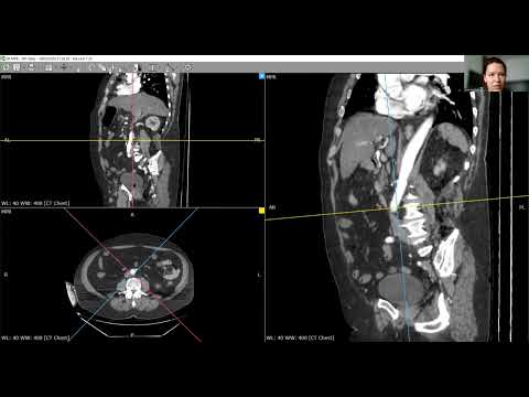 Видео: Обзор основных функций DICOM Viewer  ов на примере RadiAnt