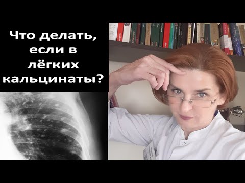 Видео: Что делать, если в легких кальцинаты