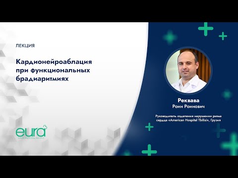 Видео: Кардионейроаблация при функциональных брадиаритмиях
