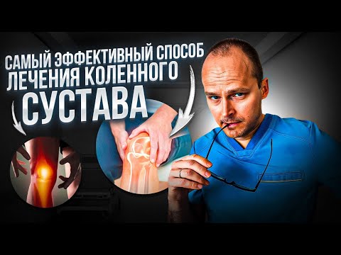 Видео: 93% ЛЮДЕЙ ЛЕЧАТ КОЛЕНО НЕПРАВИЛЬНО! Лучший метод лечения коленного сустава
