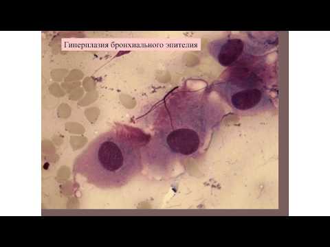Видео: Вебинары Круглого стола
