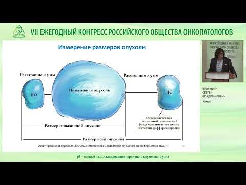 Видео: pT – первый пазл, стадирование первичного опухолевого узла