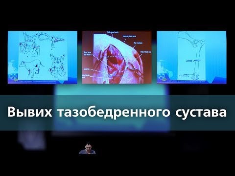 Видео: Вывих тазобедренного сустава