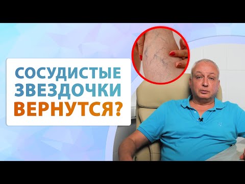 Видео: Как удалить сосудистые звездочки