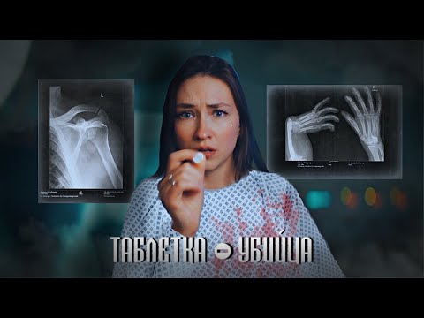 Видео: ТЫСЯЧИ ДЕТЕЙ РОДИЛИСЬ БЕЗ РУК И НОГ | Талидомидовая трагедия