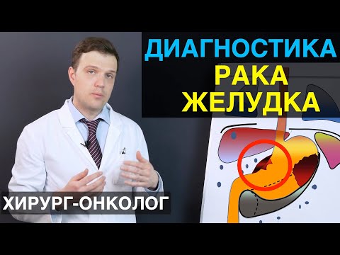 Видео: Диагностика рака желудка. Все виды диагностики рака желудка