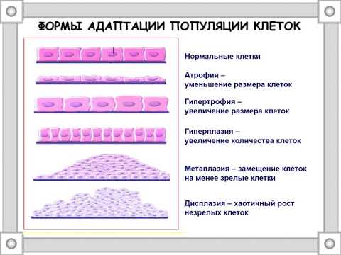 Видео: Патофизиология клетки (лектор И.Ю.Малышев)