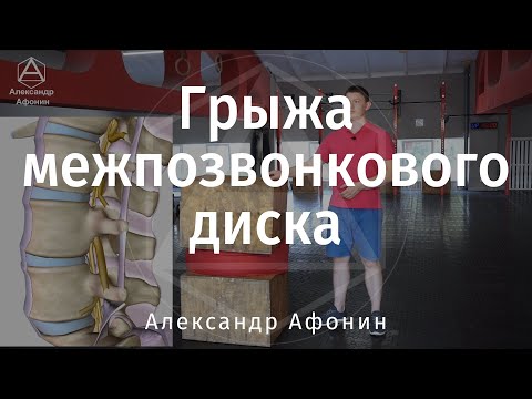 Видео: Грыжа межпозвонкового диска в любом отделе позвоночника образуется по схожим принципам