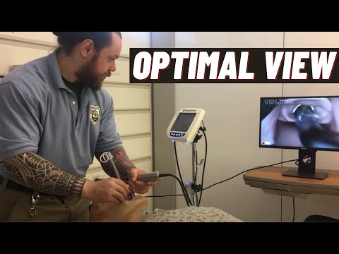Видео: Как правильно расположить пациента для интубации трахеи? GlideScope со стандартной геометрией