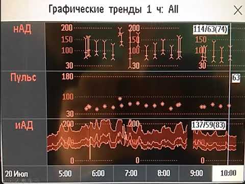 Видео: ИТ при САК Савин И.А.