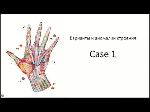 Видео: Вебинар МРО РОРР: МРТ кисти на примере клинических случаев