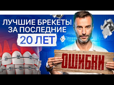 Видео: Какие брекеты выбрать? Ошибки при выборе брекетов