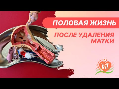 Видео: 👋​ Половая жизнь после удаления матки