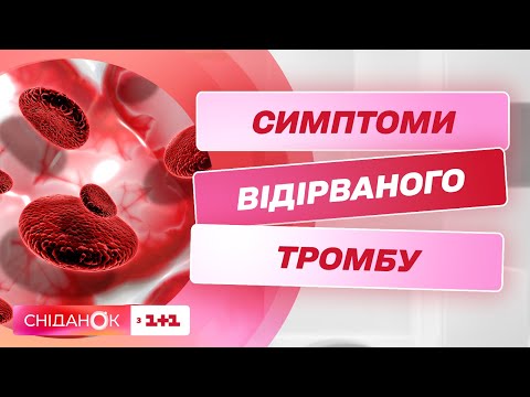 Видео: Небезпека тромбозу: що робити, коли відірвався тромб – флеболог Василь Мішнев