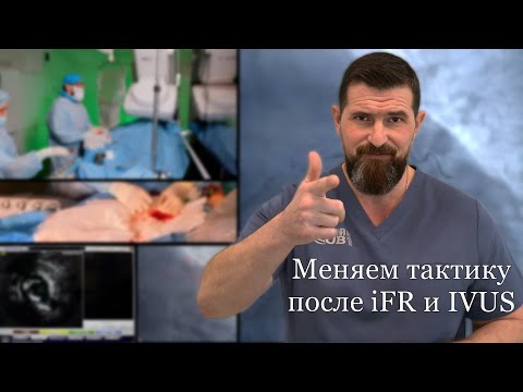 Видео: Меняем тактику после iFR и IVUS