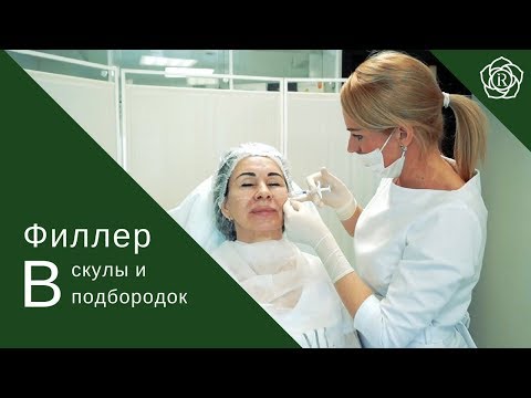 Видео: Филлер в скулы и подбородок. Авторская техника Инны Ружейниковой