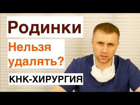 Видео: Родинки. Какие нельзя удалять?