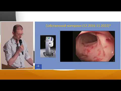 Видео: 3 Кирюхин А.П, Павлов ПВ Лучевой проктит: радиолог, проктолог, эндоскопист. Чья же "головная боль"?