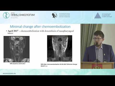 Видео: Химиоэмболизация сосудов опухоли