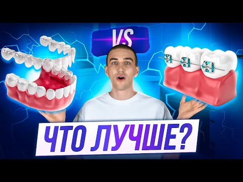 Видео: Элайнеры или Брекеты?! Как выбрать?