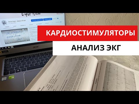 Видео: Анализ ЭКГ при кардиостимуляторе.  Нарушение работы кардиостимуляторов.