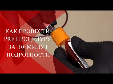 Видео: 💉Как сделать  PRF процедуру за 10 МИНУТ и ПОЧЕМУ? | Особенности работы с PRF методикой.