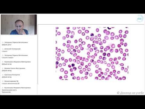 Видео: практические вопросы диагностики и терапии паразитарных болезней (запись вебинара, цикл НМО)