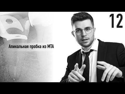 Видео: Уроки эндодонтии. Апикальная пробка из МТА