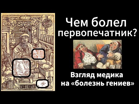 Видео: Чем болел первопечатник? "Болезнь королей и гениев" у Скорины! Лекция профессора Николая Сороки